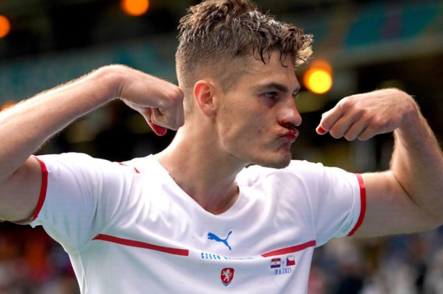 El singular récord de Patrik Schick tras el República Checa vs. Georgia