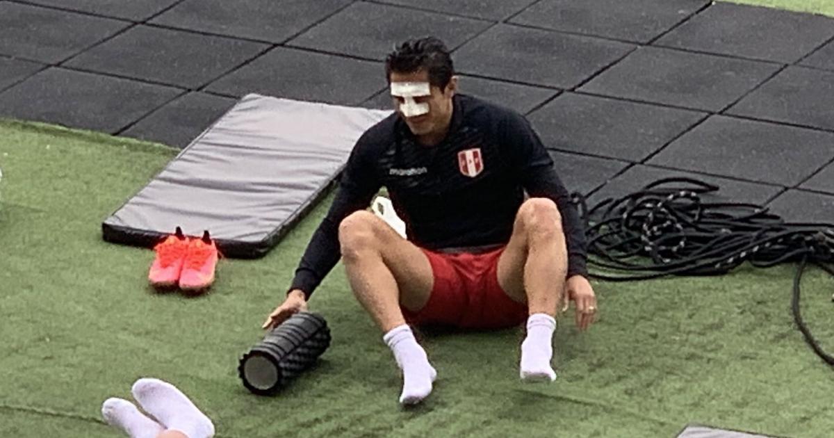 Gianluca Lapadula: ¿cómo quedó su naríz tras el duelo ante Paraguay? | FOTOS