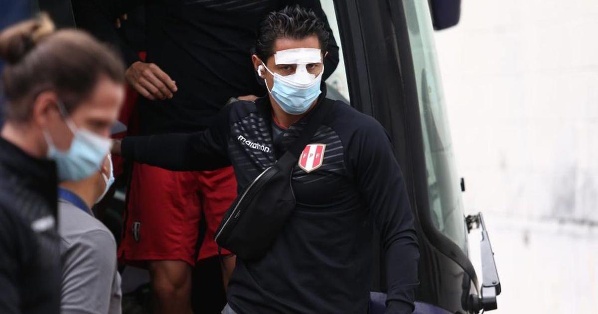 Gianluca Lapadula: ¿cómo quedó su naríz tras el duelo ante Paraguay? | FOTOS