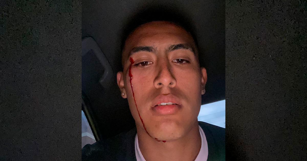 Lamentable: Fabrizio Roca fue agredido por supuestos hinchas de Cristal