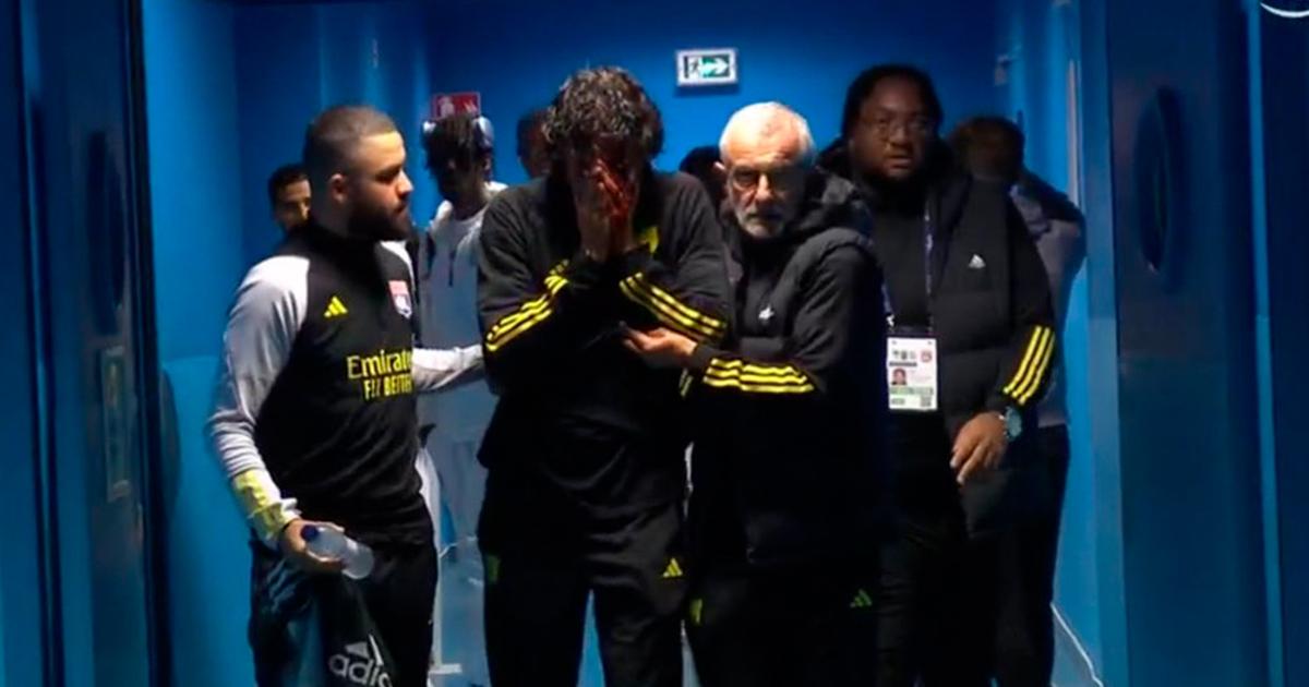 (VIDEO) Hinchas del Marsella apedrearon bus del Lyon y el partido se suspendió