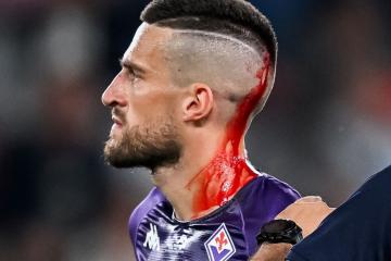 Fiorentina pide castigo tras agresión que sufrió su jugador