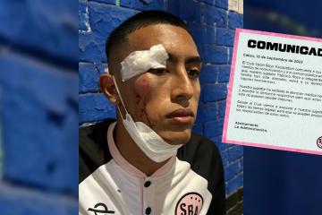 Sport Boys se pronunció tras agresión a Fabrizio Roca