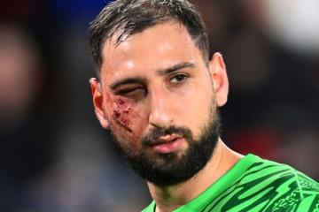 Donnarumma sufrió traumatismo facial