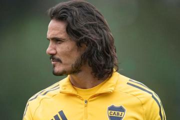 Cavani será operado para poder volver a jugar