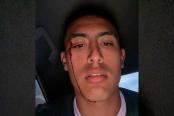 Lamentable: Fabrizio Roca fue agredido por supuestos hinchas de Cristal