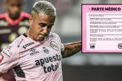 Sport Boys dio a conocer el estado de sus jugadores lesionados 