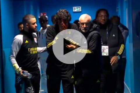(VIDEO) Hinchas del Marsella apedrearon bus del Lyon y el partido se suspendió