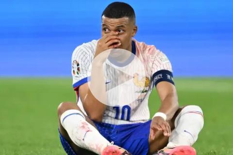 DT de Francia sobre Mbappé: "Su nariz está muy golpeada, se ve muy complicado"